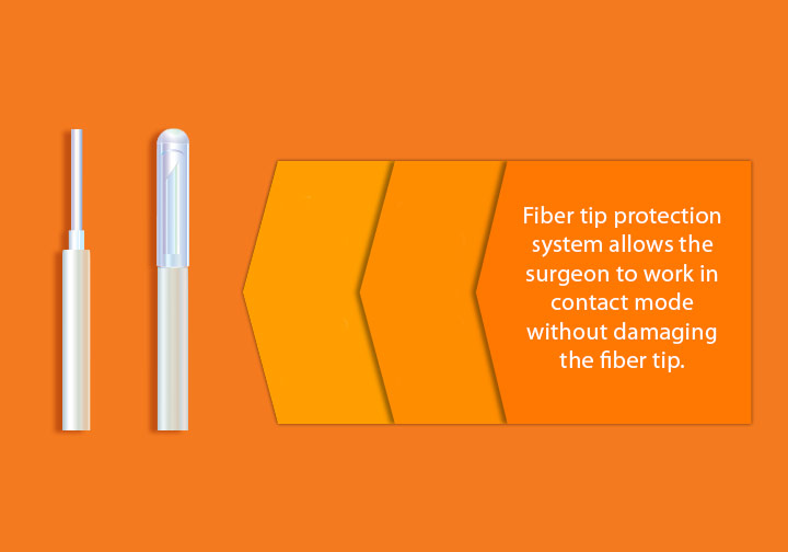 Fiber Tip Protection